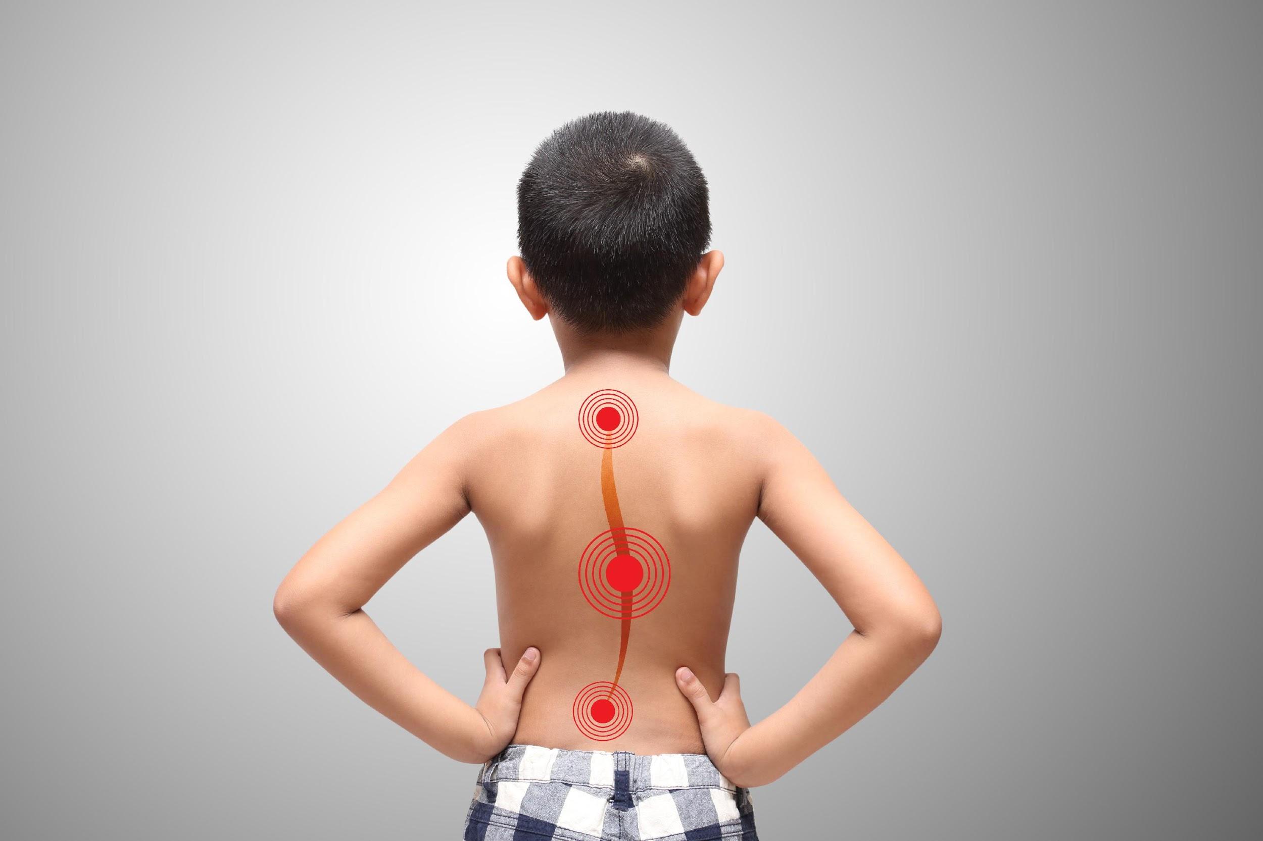 https://mdashishpatel.com/wp-content/uploads/2025/02/Pediatric-Spine-Surgery.jpg